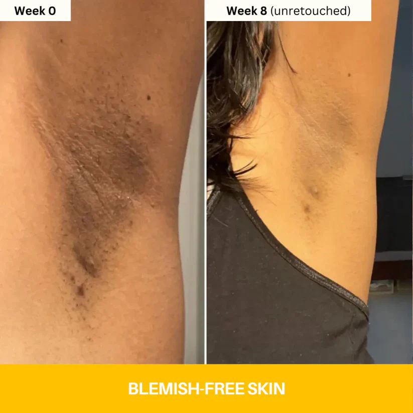 Kojic Acid Brightening Body Wash - Image 3