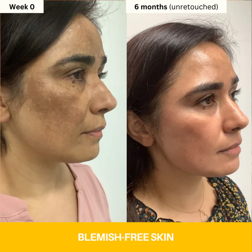 Kojic Acid Brightening Body Wash - Image 4