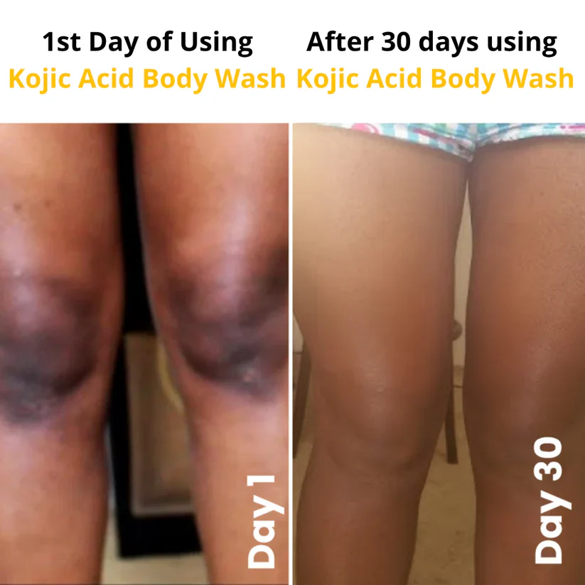 Kojic Acid Brightening Body Wash - Image 5